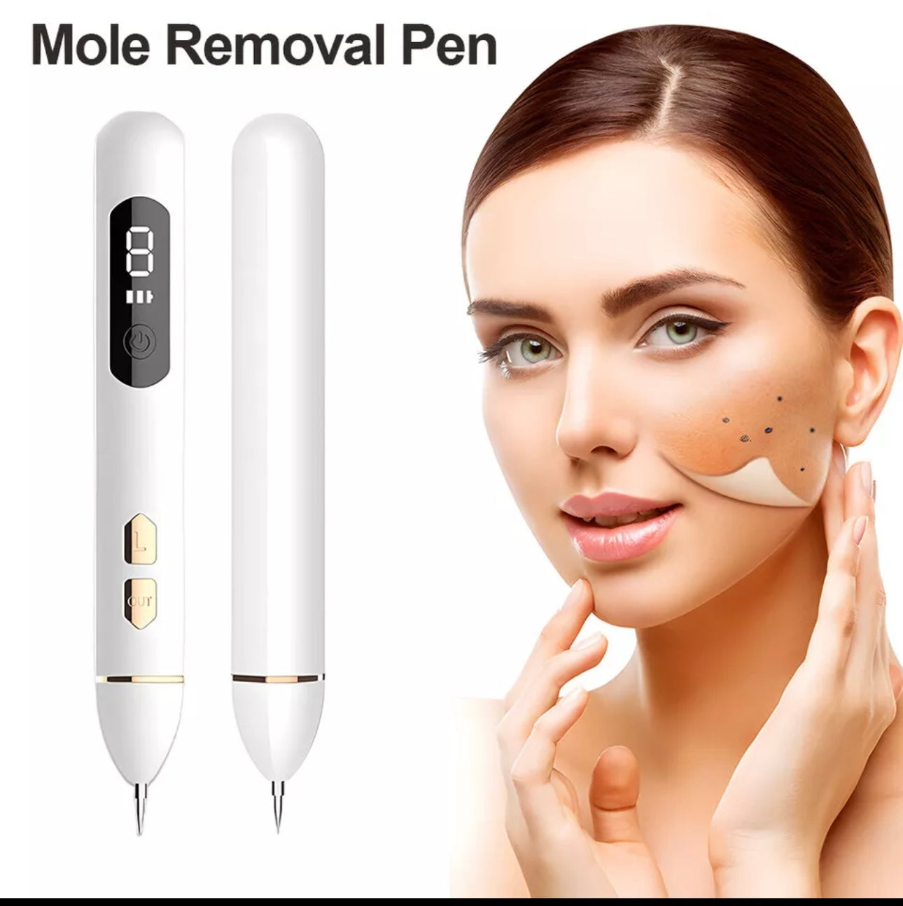 9 level plasma pen for mole removal